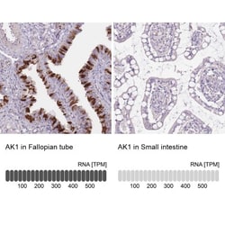 Adenylate Kinase 1 Antibody, Novus Biologicals 0.1mL; Unlabeled:Antibodies,